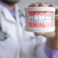 Guia de Implantes Dentários em Portugal: Tudo o Que Precisa de Saber Antes de Avançar